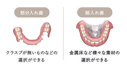 部分入れ歯・総入れ歯