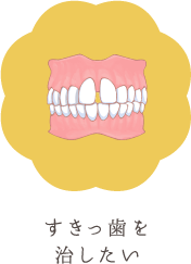 すきっ歯を治したい