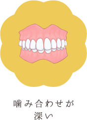 噛み合わせが深い